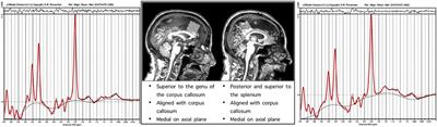 Cerebral Metabolite Concentrations Are Associated With Cortical and Subcortical Volumes and Cognition in Older Adults